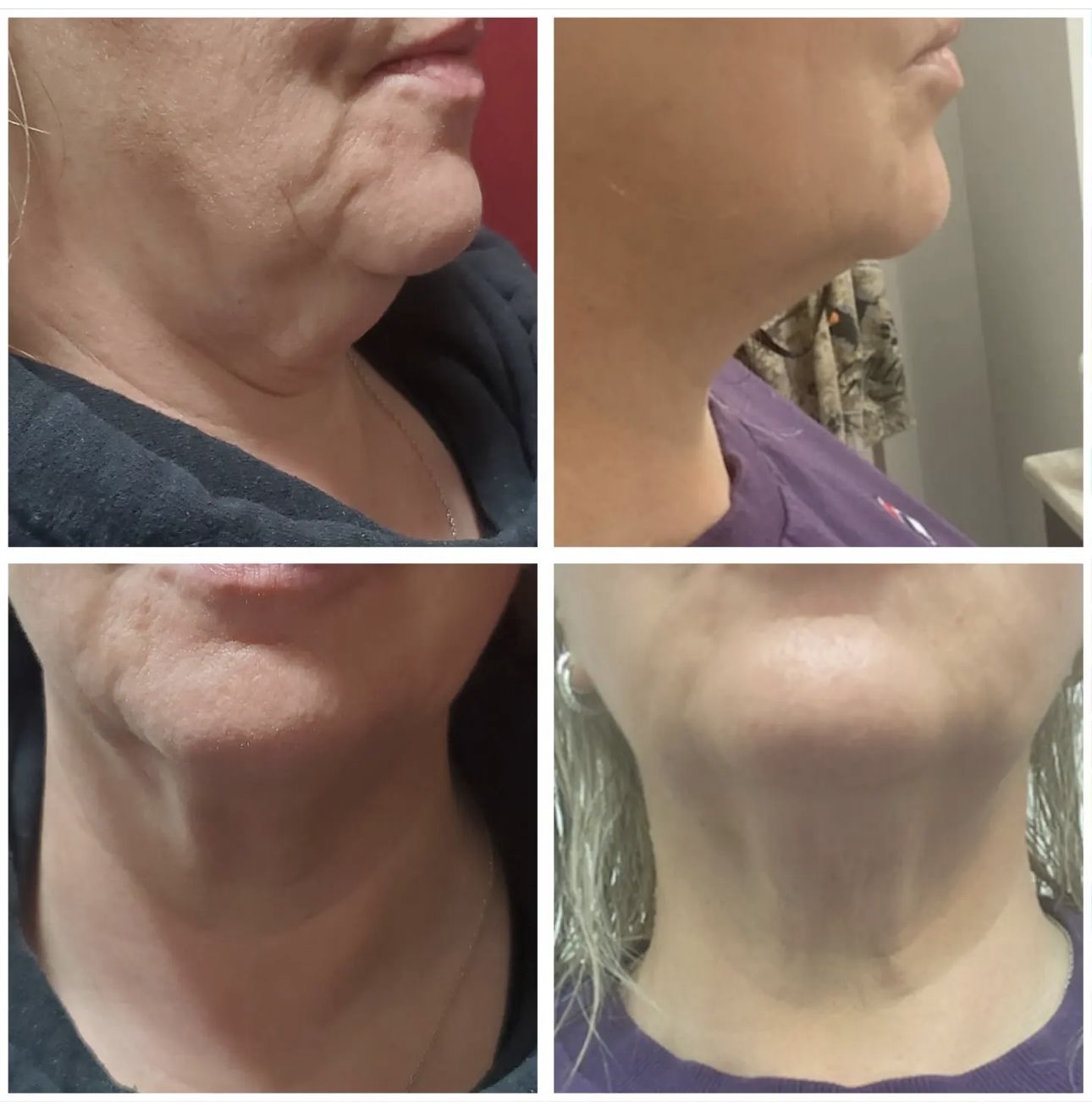 Before and after cosmetic treatment results